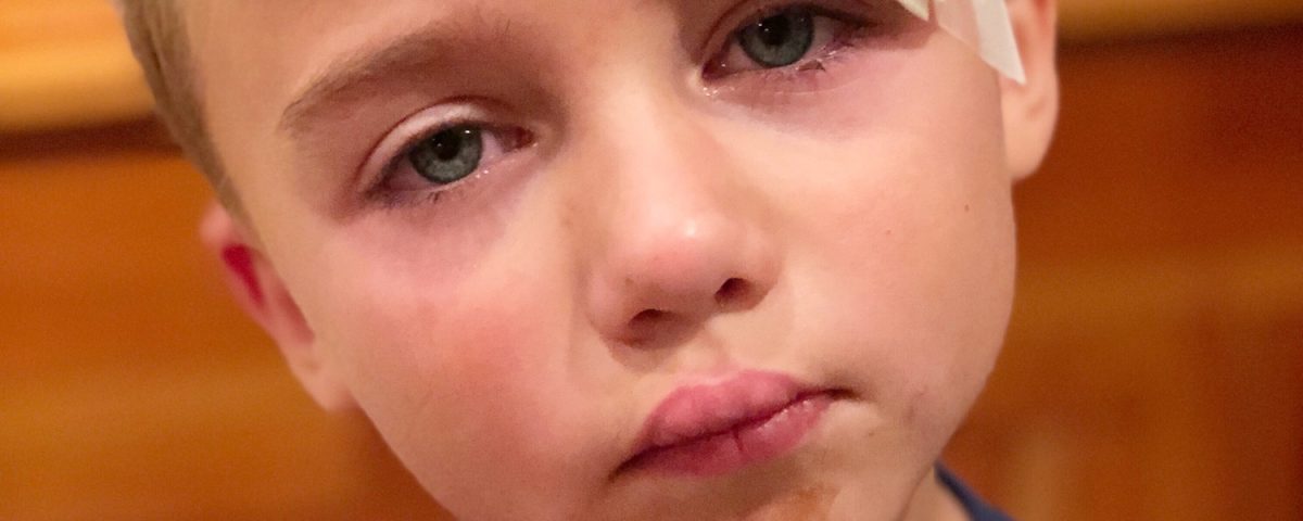 Little boy with injury to his head , with a very sad face