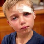 Little boy with injury to his head , with a very sad face