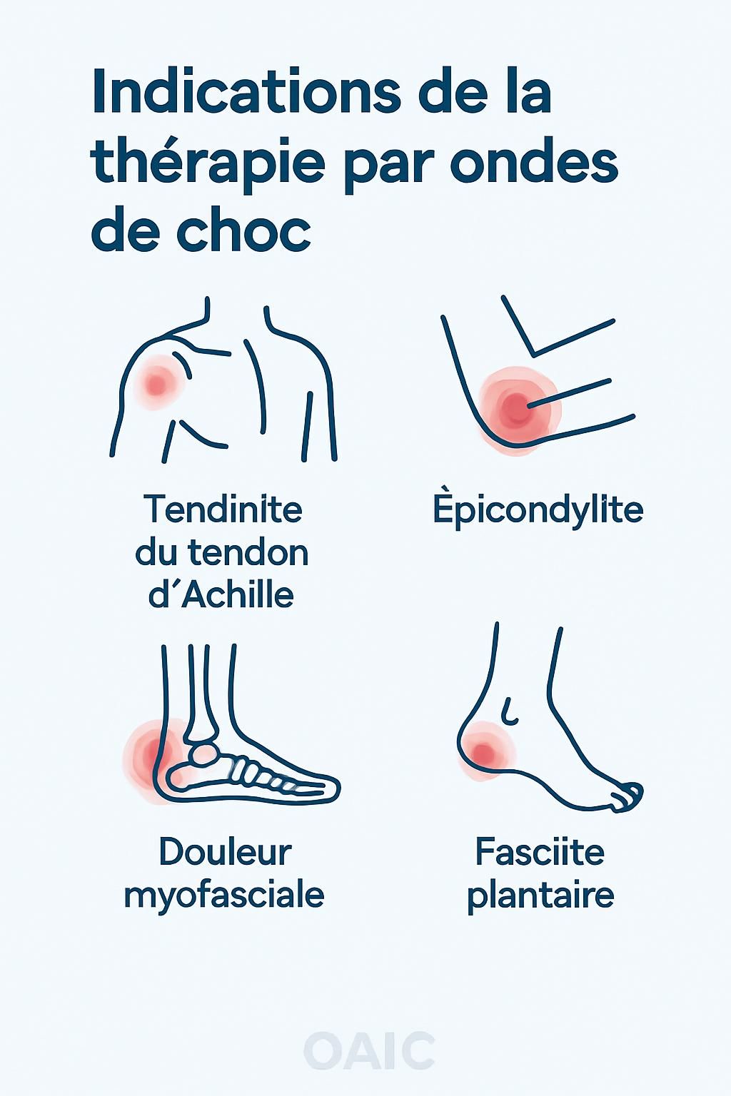 découvrez comment la thérapie par shockwave peut améliorer la qualité de vie des athlètes en favorisant la guérison rapide, réduisant la douleur et optimisant la performance sportive.